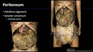 Peritoneum  Dissection Supplement [upl. by Htur]