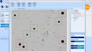 SCA DNA Fragmentation  CASA System SCA Evolution Human Edition [upl. by Ahsimot]