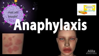 Anaphylaxis Animation [upl. by Howland920]