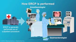 Understanding ERCP Endoscopic Retrograde Cholangiopancreatography [upl. by Cheatham]