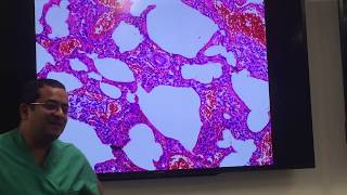 Basics of interstitial lung disease pathology explained by a pulmonary pathologist [upl. by Alaric874]