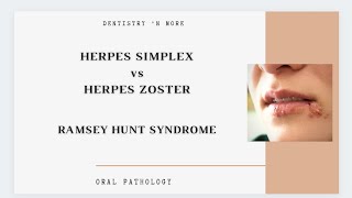 HERPES SIMPLEX Vs HERPES ZOSTER [upl. by Anama]