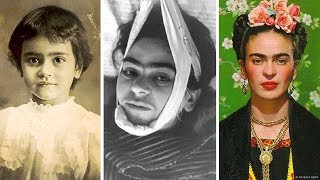 La trágica historia de Frida Kahlo [upl. by Any]