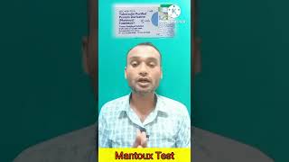 Mantoux Test  TST  PPD Tuberculin Skin Test  Diagnosis of TB shorts tuberculosis shortvideo [upl. by Nelyak]