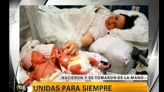 Las gemelas que nacieron tomadas de la mano  Telefe Noticias [upl. by Notyrb]