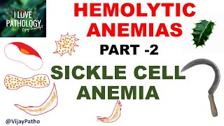 Hemolytic Anemias Part 2 SICKLE CELL ANEMIA Pathology [upl. by Hilel276]