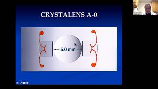 Lecture Surgical Correction of Presbyopia [upl. by Ahcilef]