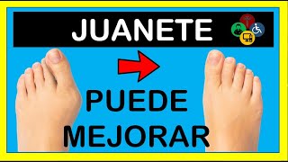 DESDE TU CASA alivia el dolor del JUANETE [upl. by Ycnay603]