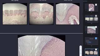 nonkeratinized stratified squamous epithelium [upl. by Squires281]