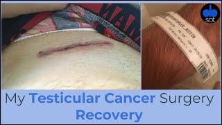 My Testicular Cancer Surgery Recovery [upl. by Ettelohcin973]