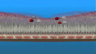 Macular Edema and Ischemia [upl. by Gale]