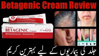 Betagenic Cream Uses and Side Effects in Urdu Hindi Betamethasone Gentamycin Cream Benefits [upl. by Ecydnac686]