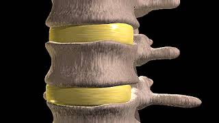 How Slipped Discs Happen Animation What’s Herniation  Herniated Nucleus Pulposus Bulging Disc Video [upl. by Odicalp68]