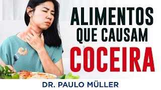 Alimentos Que Causam Coceira e Urticária  Dr Paulo Müller Dermatologista [upl. by Clemente]