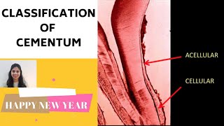 CEMENTUM  PART II II Classification of Cementum [upl. by Ecnarolf]