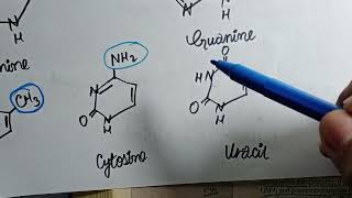 Pyramidines Synthesis amp Degradation  With Related Clinicals  Nucleotide Metabolism [upl. by Kcirre]