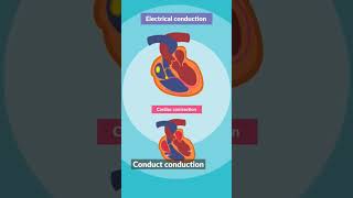 ECG Learn heart ecg ecgheart heartcondition [upl. by Nameloc]