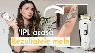 Epilarea definitivă acasă funcționează Review Braun IPL Pro 5 vs Phillips Lumea  Rezultate ipl [upl. by Lavina]