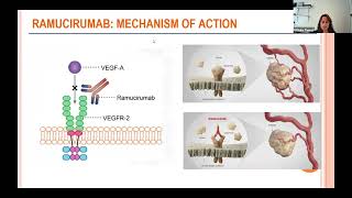 Clinical Trials for Thymic Tumors 2024 Update [upl. by Zindman451]