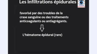 infiltration epidurale les risques et les voies dabords de infiltration epidurale [upl. by Etnovert846]