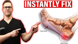 How To Cure Plantar Fasciitis FAST amp FOREVER Heel Pain amp Heel Spurs [upl. by Roddy86]