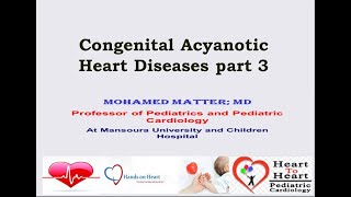 congenital acyanotic heart disease part 3 [upl. by Wicks281]