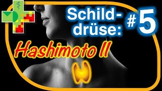 Hashimoto II Diagnostik  was ist zu beachten [upl. by Ahsiei]