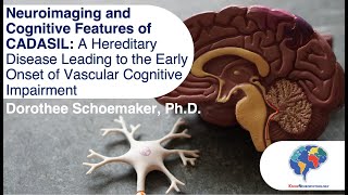 Neuroimaging and Cognitive Features of CADASIL [upl. by Llewol706]