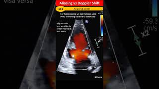 Aliasing vs Doppler Shift [upl. by Feirahs489]