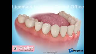 Endodontic Treatment [upl. by Ardyce876]