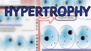 Hypertrophy  Classification  Examples [upl. by Haven]