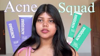 Unsponsered Acne Squad Review  Spot Corrector and Facewash Review [upl. by Pineda]