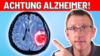 Demenz amp Alzheimer  TOP 10 SCHÄDLICHSTEN Dinge für Dein GEHIRN [upl. by Irrab438]