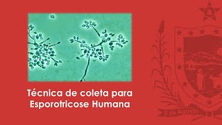 Técnica de coleta para Esporotricose Humana [upl. by Ermey219]