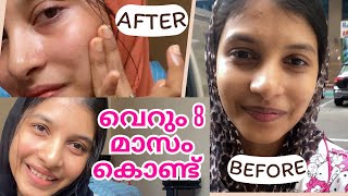 💯😳quotഎങ്ങനെ ഇത്ര glow ആയി quot My skin care products  Selmadinash [upl. by Marne628]