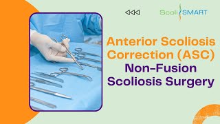 Anterior Scoliosis Correction ASC Non Fusion Scoliosis Surgery scoliosis ASC [upl. by Deenya]