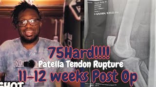 Patellar Tendon Rupture Recovery Week 1112  75 Hard [upl. by Danni130]