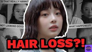 SOJUWOON NewJeans Hanni Faces Hair Loss Rumors Whats Really Happening Kpop News🌟 [upl. by Cr738]