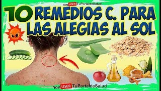 10 Remedios Para Alergias del SolREMEDIOS CASEROS PARA LAS ALERGIAS EN LA PIEL [upl. by Malvia]