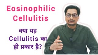 Eosinophilic Cellulitis  Wells syndrome क्या यह Cellulitis का ही प्रकार है cellulitis red rashes [upl. by Akena554]