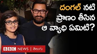 Suhani Bhatnagar ‘దంగల్’ నటి ప్రాణం తీసిన వ్యాధి లక్షణాలు ఏమిటి  BBC Telugu [upl. by Evilo]