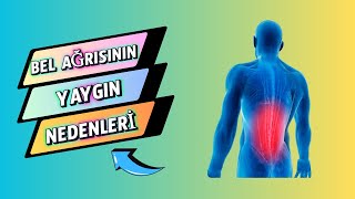 Bel Ağrısının En Yaygın Nedenleri [upl. by Kasper]