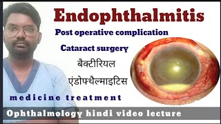 endophthalmitis  endophthalmitis treatment  endophthalmitis  endophthalmitis disease [upl. by Adaran681]