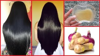 Ginger Onion Hair Mask How To Get Thick Hair Healthy Hair Long Hair Faster with Ginger Onion [upl. by Madison216]