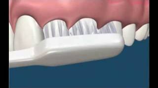 Tooth Brushing Technique  Dental hygiene in Sydney Castle Hill Australia call 02 9659 1200 [upl. by Karlotte809]