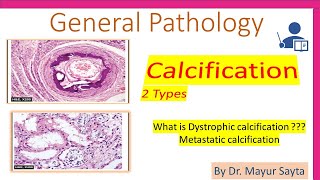 Pathological Calcification [upl. by Ahaelam]