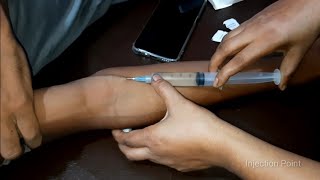 iv injection video iv Ceftriaxone 1g injection push 23 Ep27 Injection point [upl. by Klara]