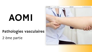 AOMI  Pathologies vasculaires 2ème partie [upl. by Anak]