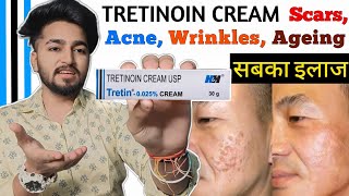 Tretinoin Cream Complete Information  Tretinoin Cream Benifits and Side Effects  Tretin Cream [upl. by Allerus]