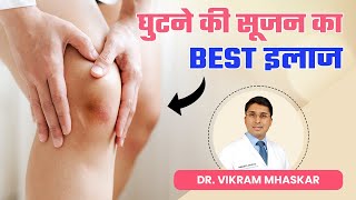 घुटने में सूजन क्या होता है घुटने की सूजन का Best इलाज  Best Doctors for Knee Effusion in Delhi [upl. by Arretahs]